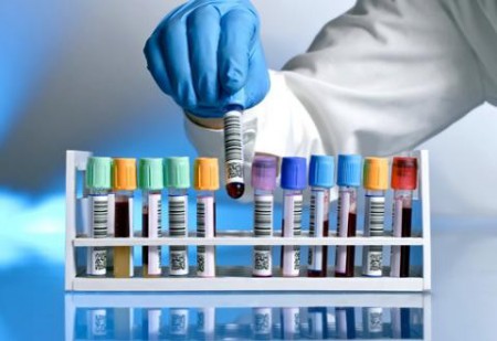 Biometría Hemática